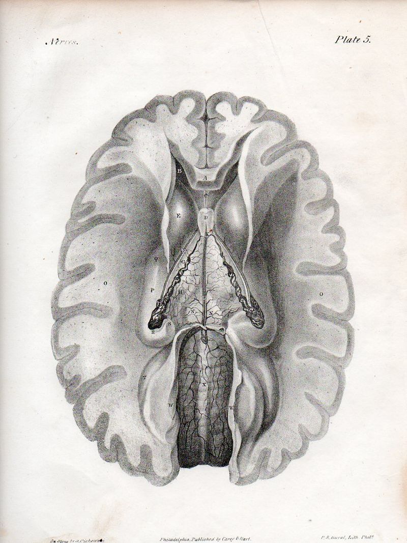 Brain524
