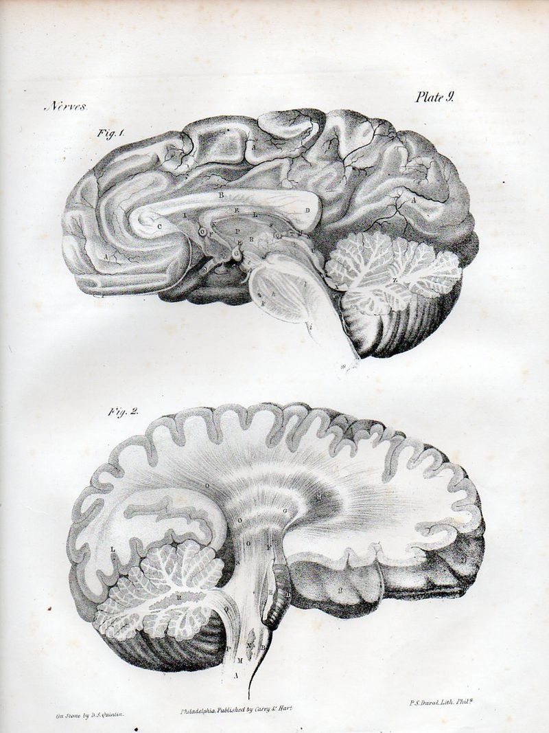 Brain528